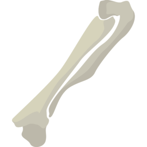 Desecrated Bones (item).png